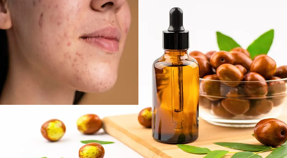 Jojoba Oil